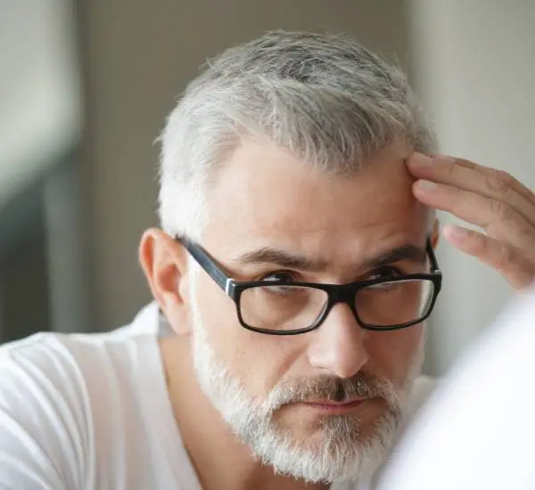Acne and Hair Loss